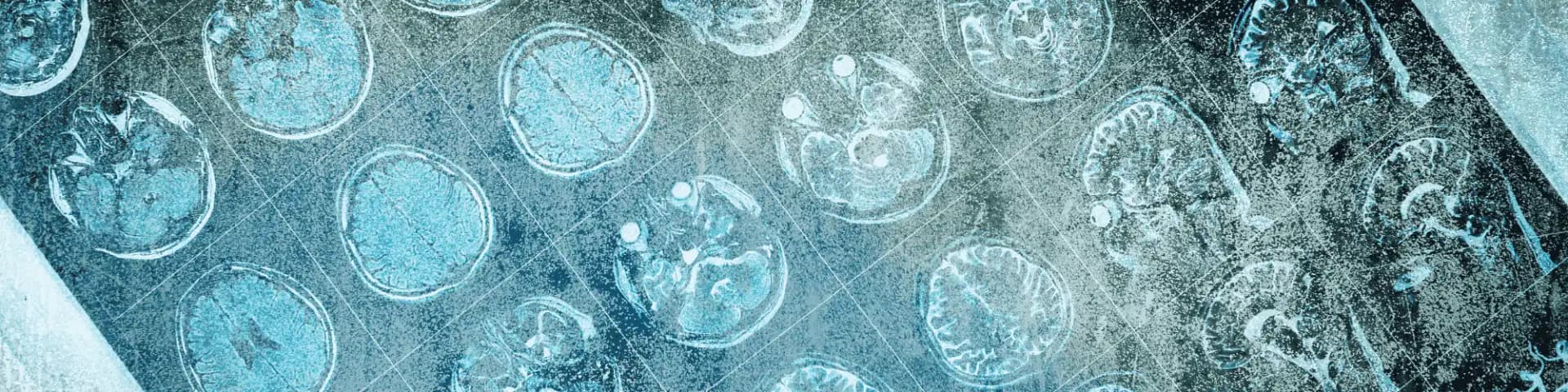 The Neurophysiology of Sobriety: Find LA AA Meetings for Long-Term Recovery Discover the neurophysiology behind sobriety