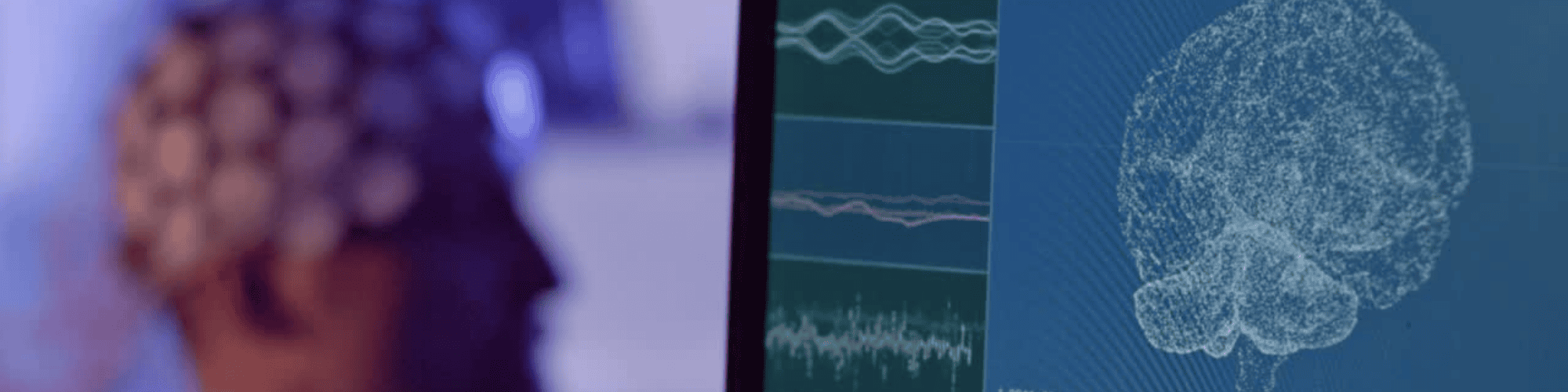 neuroscience neuroscience imagery