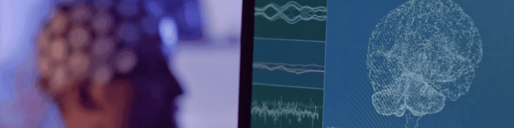 neuroscience neuroscience imagery