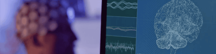 The Neuroscience of Connection: How AA Meetings Rewire the Brain for Sobriety